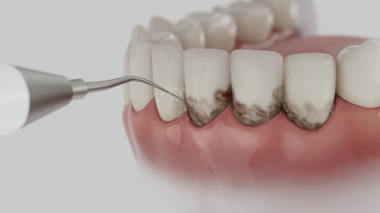 Trusted Root Canal Treatment service in Saltillo, MS - Dentist Open Now
